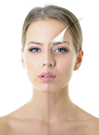 chemical peel concept